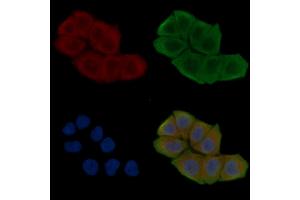 ABIN6263092 and ABIN6276728 staining Hela cells(30 min of UV treatment) by IF/ICC.