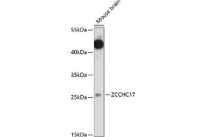 Western blot analysis of extracts of mouse brain, using ZCCHC17 antibody (ABIN7271546) at 1:1000 dilution. (ZCCHC17 Antikörper  (AA 1-241))