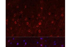 Immunofluorescence analysis of Rat brain using SLC1A1 Polyclonal Antibody at dilution of 1:100. (SLC1A1 Antikörper)