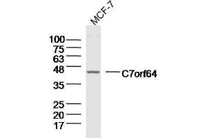 Lane 1: MCF-7 lysates probed with C7orf64 Polyclonal Antibody, Unconjugated  at 1:300 overnight at 4˚C. (C7orf64 Antikörper  (AA 1-100))