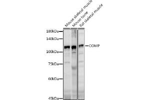 Western blot analysis of extracts of various cell lines, using COMP antibody (ABIN6127650, ABIN6138864, ABIN6138866 and ABIN6221502) at 1:1000 dilution. (COMP Antikörper  (AA 20-160))