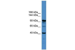 WB Suggested Anti-IFT88  Antibody Titration: 0. (IFT88 Antikörper  (Middle Region))