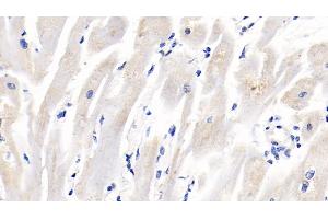 Immunohistochemistry (IHC) image for anti-Insulin-Like Growth Factor Binding Protein 2, 36kDa (IGFBP2) (AA 30-316) antibody (ABIN7430597)
