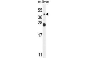 Western Blotting (WB) image for anti-Sialidase 4 (NEU4) antibody (ABIN2995626) (Sialidase 4 Antikörper)
