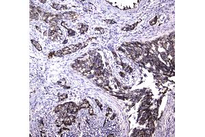 IHC analysis of MRE11 using anti-MRE11 antibody .