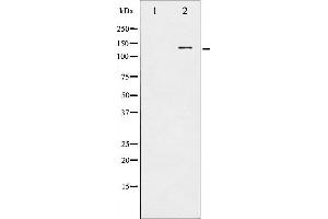 Western blot analysis of CBL phosphorylation expression in Na2VO3 treated HepG2 whole cell lysates,The lane on the left is treated with the antigen-specific peptide.