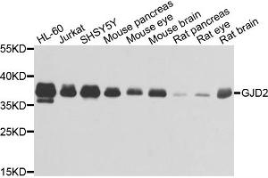 Western blot analysis of extracts of various cell lines, using GJD2 antibody (ABIN1872826) at 1:1000 dilution. (GJD2 Antikörper)
