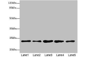 Western blot All lanes: RAB9A antibody at 7. (RAB9A Antikörper  (AA 122-201))