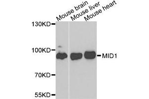 Western blot analysis of extracts of various cells, using MID1 antibody.