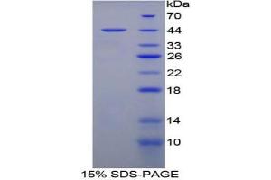 SDS-PAGE analysis of Rat MEC Protein. (Mucosae Associated Epithelia Chemokine Protein)