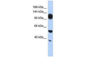 WB Suggested Anti-WDHD1 Antibody Titration: 0. (WDHD1 Antikörper  (Middle Region))