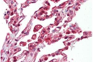 Anti-EIF4B antibody IHC staining of human lung. (EIF4B Antikörper  (AA 150-200))