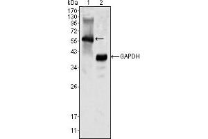 Image no. 2 for anti-Megakaryocyte-Associated tyrosine Kinase (MATK) antibody (ABIN466781) (MATK Antikörper)