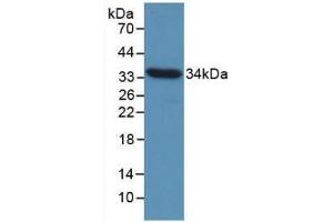 Western blot analysis of recombinant Chicken CCND1. (Cyclin D1 Antikörper  (AA 1-292))