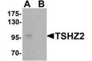 Western blot analysis of TSHZ2 in A-20 cell lysate with TSHZ2 Antibody  at 1 µg/ml in (A) the absence and (B) the presence of blocking peptide. (TSHZ2 Antikörper  (N-Term))