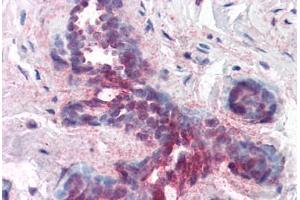 Human Breast (formalin-fixed, paraffin-embedded) stained with PDCD4 antibody ABIN214444 at 1. (PDCD4 Antikörper  (pSer457))