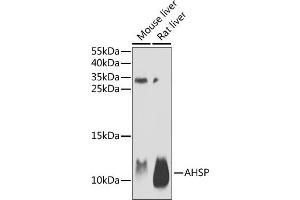 Western blot analysis of extracts of various cell lines, using AHSP antibody (ABIN6131912, ABIN6136672, ABIN6136673 and ABIN6222122) at 1:1000 dilution. (aHSP Antikörper  (AA 1-102))