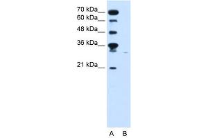 Western Blotting (WB) image for anti-Solute Carrier Family 22 (Organic Cation Transporter), Member 7 (SLC22A7) (C-Term) antibody (ABIN2775547)