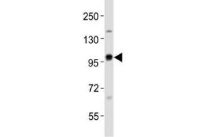 Western blot testing of EZH2 antibody at 1:1000 dilution + rat C6 lysate; Predicted size : 85-95 kDa. (EZH2 Antikörper)