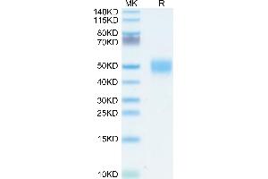 Human GPA34/VSIG1 on Tris-Bis PAGE under reduced condition. (VSIG1 Protein (AA 22-232) (His tag))