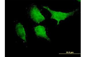 Immunofluorescence of purified MaxPab antibody to TRAF6 on HeLa cell. (TRAF6 Antikörper  (AA 1-522))