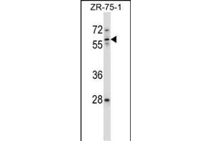 IC Antibody (Center) (ABIN657631 and ABIN2846627) western blot analysis in ZR-75-1 cell line lysates (35 μg/lane). (ICAM-3/CD50 Antikörper  (AA 282-310))