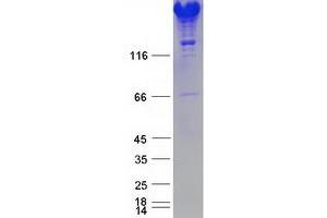 Western Blotting (WB) image for Spectrin alpha Chain, Brain (SPTAN1) (Transcript Variant 2) protein (Myc-DYKDDDDK Tag) (ABIN2732545)