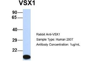 Host:  Rabbit  Target Name:  VSX1  Sample Type:  Human 293T  Antibody Dilution:  1. (VSX1 Antikörper  (Middle Region))