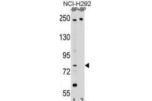 Western Blotting (WB) image for anti-Adaptor Protein, phosphotyrosine Interaction, PH Domain and Leucine Zipper Containing 2 (APPL2) antibody (ABIN2999473)