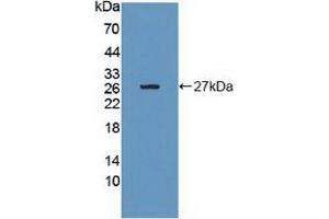 Western blot analysis of recombinant Human Grb10. (GRB10 Antikörper  (AA 392-594))