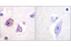 Immunohistochemistry analysis of paraffin-embedded human brain, using FAK (Phospho-Tyr576) Antibody. (FAK Antikörper  (pTyr576))