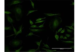 Immunofluorescence of monoclonal antibody to PCNA on HeLa cell. (PCNA Antikörper  (AA 78-177))