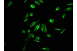Immunofluorescence staining of Hela cells with ABIN7139270 at 1:2. (HIST1H2AG Antikörper  (2meArg11))