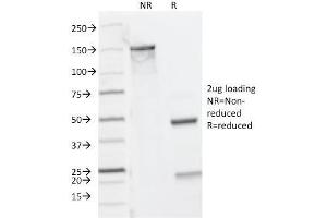 SDS-PAGE Analysis Purified CD8A Mouse Monoclonal Antibody (C8/144B). (CD8 alpha Antikörper  (C-Term, Cytoplasmic Domain))
