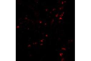 Immunofluorescence of LAMP1 in human colon tissue with LAMP1 polyclonal antibody  at 20 ug/mL . (LAMP1 Antikörper  (Internal Region))