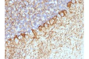 anti-NEFH & NEFL antibody