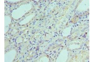 Immunohistochemistry of paraffin-embedded human kidney tissue using ABIN7143342 at dilution of 1:100