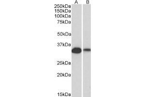 Western Blotting (WB) image for anti-Membrane-Spanning 4-Domains, Subfamily A, Member 1 (MS4A1) (C-Term) antibody (ABIN570905)