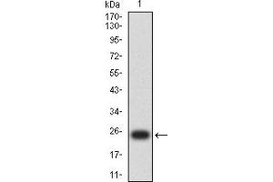 Western blot analysis using S100B mAb against human S100B (AA: 1-92) recombinant protein.