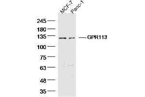Lane 1: MCF-7 Cell lysates, Lane 2: Panc-1 Cell lysates, probed with GPR113 Polyclonal Antibody, unconjugated  at 1:300 overnight at 4°C followed by a conjugated secondary antibody for 60 minutes at 37°C. (GPR113 Antikörper  (AA 1-100))