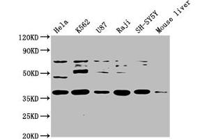 Western Blot Positive WB detected in: Hela whole cell lysate, K562 whole cell lysate, U87 whole cell lysate, Raji whole cell lysate, SH-SY5Y whole cell lysate, Mouse liver tissue All lanes: SS18L1 antibody at 1:2000 Secondary Goat polyclonal to rabbit IgG at 1/50000 dilution Predicted band size: 43, 41, 34, 30, 44 kDa Observed band size: 43 kDa (SS18L1 Antikörper  (AA 47-396))