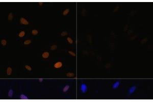 Immunofluorescence (IF) image for anti-Histone H4 (acLys16) antibody (ABIN7261235)