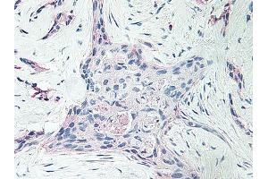Image no. 1 for anti-Platelet Factor 4 (PF4) antibody (ABIN465152) (PF4 Antikörper)