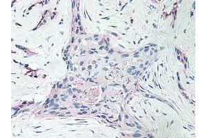 Image no. 1 for anti-Platelet Factor 4 (PF4) antibody (ABIN465152)
