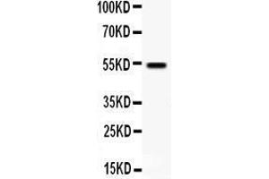 Anti- VIPR1 antibody, Western blotting All lanes: Anti VIPR1  at 0.
