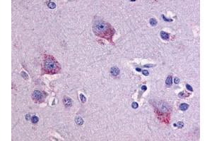 Anti-LPHN1 antibody IHC of human brain, neurons and glia. (Latrophilin 1 Antikörper  (C-Term))
