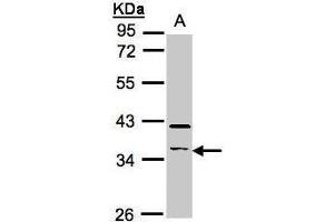 WB Image Sample(30 ug whole cell lysate) A:Raji , 10% SDS PAGE antibody diluted at 1:500 (RASSF2 Antikörper  (Center))