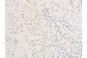 Immunohistochemistry (IHC) image for anti-Baculoviral IAP Repeat-Containing 5 (BIRC5) (pThr117) antibody (ABIN6255588)
