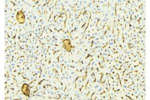 Immunohistochemistry (IHC) image for anti-Cytochrome P450, Family 2, Subfamily A, Polypeptide 7 (CYP2A7) antibody (ABIN6258489)