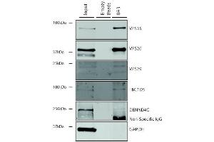 Immunoprecipitation analysis using Mouse Anti-VPS35 Monoclonal Antibody, Clone 8A3 (ABIN6932958). (VPS35 Antikörper  (Atto 488))